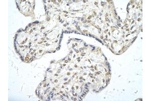 Rabbit Anti-PPARD antibody        Paraffin Embedded Tissue:  Human Placenta cell   Cellular Data:  Epithelial cells of renal tubule  Antibody Concentration:   4. (PPARD Antikörper  (C-Term))