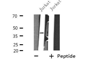 Western blot analysis of extracts from Jurkat cells, using GTF3A antibody. (GTF3A Antikörper  (N-Term))