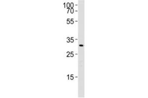 Western blot analysis of lysate from rat liver using Cebpb antibody. (CEBPB Antikörper  (AA 99-131))