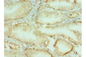 Immunohistochemistry of paraffin-embedded human prostate tissue using ABIN7148221 at dilution of 1:100 (COL1A1 Antikörper  (AA 521-680))