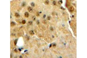 IHC-P analysis of Brain tissue, with DAB staining. (PRNP Antikörper  (AA 23-230))