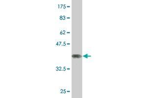 Western Blot detection against Immunogen (37. (NCOA4 Antikörper  (AA 505-614))