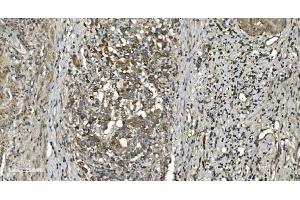 IHC analysis of RGS6 using anti-RGS6 antibody (ABIN7602326). (RGS6 Antikörper  (AA 7-357))