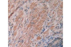 DAB staining on IHC-P; Samples: Human Prostate Gland Tissue (IL12A Antikörper  (AA 23-219))