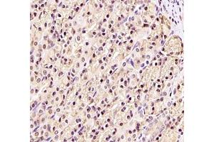 Immunohistochemistry (Paraffin-embedded Sections) (IHC (p)) image for anti-DEAD (Asp-Glu-Ala-As) Box Polypeptide 19B (DDX19B) antibody (ABIN7073694)