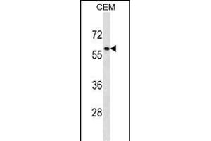 TRIM58 Antibody (C-term) (ABIN1537364 and ABIN2850371) western blot analysis in CEM cell line lysates (35 μg/lane). (TRIM58 Antikörper  (C-Term))