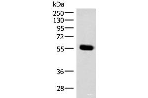 Western blot analysis of Mouse pancreas tissue lysate using IPPK Polyclonal Antibody at dilution of 1:350 (IPPK Antikörper)
