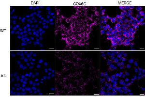 anti-Cytochrome C Oxidase Subunit VIc (COX6C) antibody