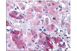 Human Adrenal: Formalin-Fixed, Paraffin-Embedded (FFPE) (TNIP3 Antikörper  (C-Term))
