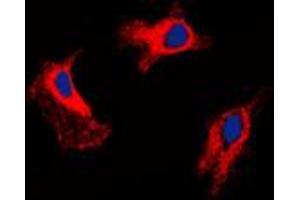 Immunofluorescence (IF) image for anti-Matrix Metallopeptidase 9 (Gelatinase B, 92kDa Gelatinase, 92kDa Type IV Collagenase) (MMP9) (C-Term) antibody (ABIN7296322)