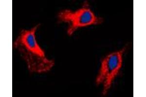 Immunofluorescent analysis of MMP9 staining in HuvEc cells. (MMP 9 Antikörper  (C-Term))