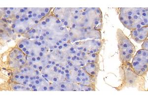 Detection of PIIINP in Mouse Pancreas Tissue using Polyclonal Antibody to Procollagen III N-Terminal Propeptide (PIIINP) (PIIINP Antikörper  (AA 24-154))