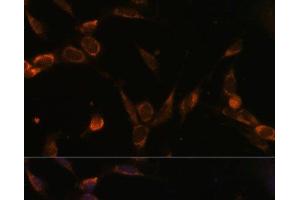 Immunofluorescence analysis of NIH-3T3 cells using USP30 Polyclonal Antibody at dilution of 1:100 (40x lens). (Usp30 Antikörper)