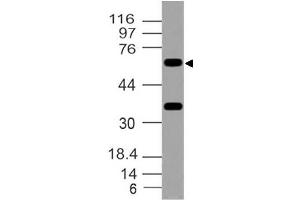 Image no. 1 for anti-Forkhead Box O1 (FOXO1) antibody (ABIN5026986)