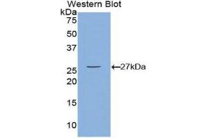Western Blotting (WB) image for anti-Calcium/calmodulin-Dependent Protein Kinase II gamma (CAMK2G) (AA 75-281) antibody (ABIN3208166) (CAMKII gamma Antikörper  (AA 75-281))