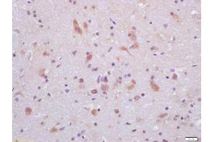 Formalin-fixed and paraffin embedded rat brain labeled with Anti-GLP-1 Polyclonal Antibody, Unconjugated (ABIN730003) at 1:200 followed by conjugation to the secondary antibody and DAB staining (GLP-1 Antikörper  (AA 1-31))