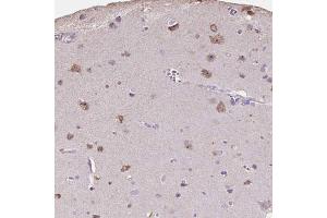 Immunohistochemical staining (Formalin-fixed paraffin-embedded sections) of human cerebral cortex shows moderate cytoplasmic and nucleolar positivity in neuronal cells with PNMA2 polyclonal antibody . (PNMA2 Antikörper  (AA 58-206))