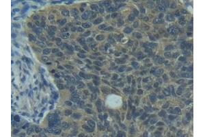 Immunohistochemistry (IHC) image for anti-Fas Ligand (TNF Superfamily, Member 6) (FASL) antibody (ABIN7439063)