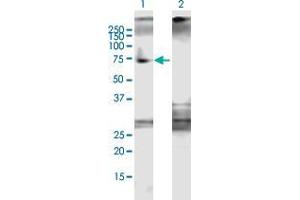 Western Blotting (WB) image for anti-DEAD (Asp-Glu-Ala-Asp) Box Polypeptide 5 (DDX5) (AA 1-614) antibody (ABIN2566127)
