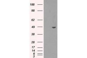 Western Blotting (WB) image for anti-Sorbitol Dehydrogenase (SORD) antibody (ABIN1501077)