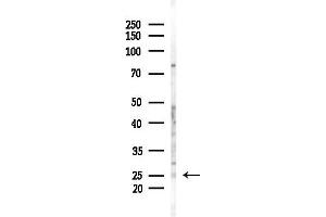 anti-RNA Binding Protein with Multiple Splicing (RBPMS) (C-Term) antibody