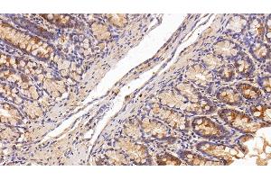 Immunohistochemistry (IHC) image for anti-Angiogenin (ANG) (AA 25-147) antibody (ABIN7430312)