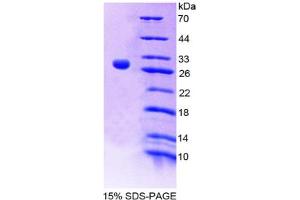 Image no. 1 for Interleukin 9 Receptor (IL9R) (AA 47-257) protein (His tag) (ABIN6237933)