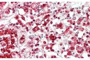 Immunohistochemistry (IHC) image for anti-ATP-Binding Cassette, Sub-Family G (WHITE), Member 1 (ABCG1) (AA 79-312) antibody (ABIN7433387)