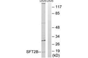 Western blot analysis of extracts from LOVO cells, using SFT2B Antibody. (Vesicle Transport Protein SFT2B (SFT2B) (AA 61-110) Antikörper)