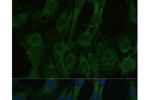 Immunofluorescence analysis of C6 cells using FABP7 Polyclonal Antibody at dilution of 1:100. (FABP7 Antikörper)