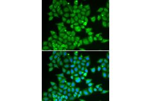 Immunofluorescence analysis of U2OS cells using PDE1B antibody. (PDE1B Antikörper  (AA 190-536))
