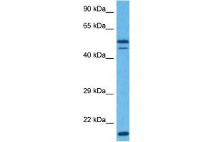 Host:  Rabbit  Target Name:  EIF3E  Sample Tissue:  Human Hela Whole Cell  Antibody Dilution:  1ug/ml (EIF3E Antikörper  (Middle Region))