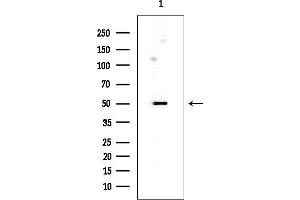 anti-T-Box 22 (TBX22) (N-Term) antibody