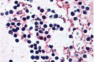 ABIN570839 (5µg/ml) staining of paraffin embedded Human peripheral blood leukocytes. (NLRP3 Antikörper  (N-Term))