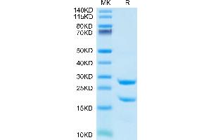 Rat MASP2 on Tris-Bis PAGE under reduced condition. (MASP2 Protein (AA 287-685) (His tag))