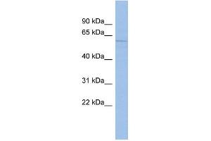 WB Suggested Anti-MCOLN3 Antibody Titration:  0. (Mucolipin 3 Antikörper  (Middle Region))