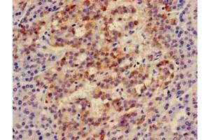 Immunohistochemistry of paraffin-embedded human pancreatic tissue using ABIN7156336 at dilution of 1:100 (IRS2 Antikörper  (AA 766-1001))