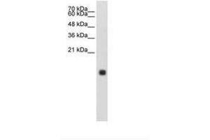 Image no. 1 for anti-Cystatin S (CST4) (N-Term) antibody (ABIN203409) (CST4 Antikörper  (N-Term))