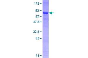 Image no. 2 for Interleukin-1 Receptor-Associated Kinase 4 (IRAK4) (AA 1-460) protein (GST tag) (ABIN1308067)