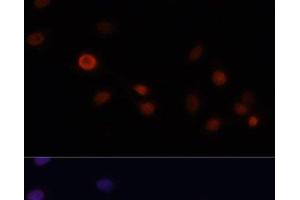 Immunofluorescence analysis of C6 cells using p21 Polyclonal Antibody at dilution of 1:100. (p21 Antikörper)
