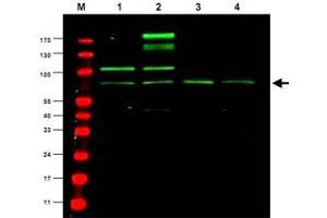 Western blot using Rreb1 polyclonal antibody  shows detection ofa predominant band believed to be Rreb1 invarious cell lysates (1 - HEK293, 2 - RFP-Rreb transfected HEK293, 3 - M460 and 4 - T1165).