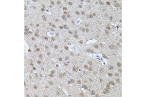 Immunohistochemistry of paraffin-embedded mouse brain using RNF166 antibody (ABIN6135036, ABIN6147021, ABIN6147024 and ABIN6224290) (40x lens). (RNF166 Antikörper  (C-Term))