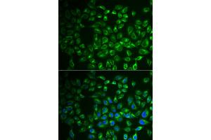 Immunofluorescence analysis of A549 cells using FABP6 antibody. (FABP6 Antikörper)