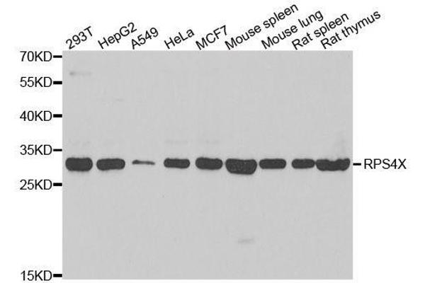 RPS4X Antikörper  (AA 66-263)