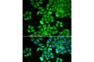 Immunofluorescence analysis of HeLa cells using ARHGDIA Polyclonal Antibody (ARHGDIA Antikörper)