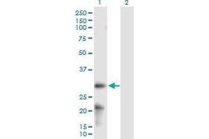 Lane 1: ARL6IP6 transfected lysate ( 24. (ARL6IP6 293T Cell Transient Overexpression Lysate(Denatured))