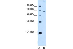 Western Blotting (WB) image for anti-Solute Carrier Family 22 (Organic Cation Transporter), Member 2 (SLC22A2) antibody (ABIN2462742) (SLC22A2 Antikörper)