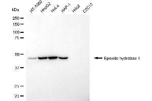 Western blotting analysis using epoxide hydrolase 1 antibody (ABIN7798483). (EPHX1 Antikörper)