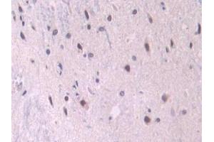Immunohistochemistry (IHC) image for anti-Endoglin (ENG) (AA 26-136) antibody (ABIN7432976)