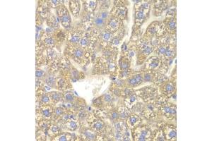 Immunohistochemistry of paraffin-embedded mouse liver using CYP2C18 antibody.
